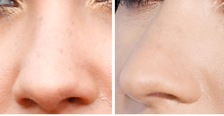 Guess The Celeb Nose!