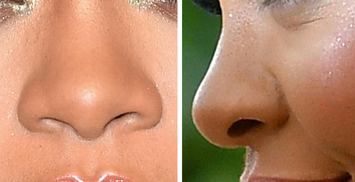 Guess The Celeb Nose!