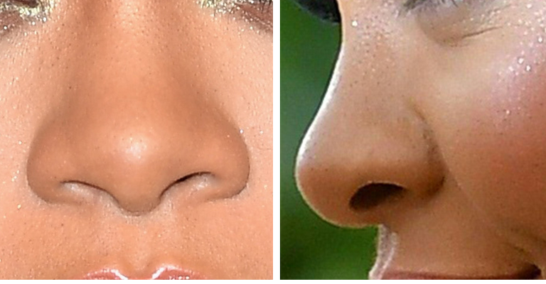 Guess The Celeb Nose!