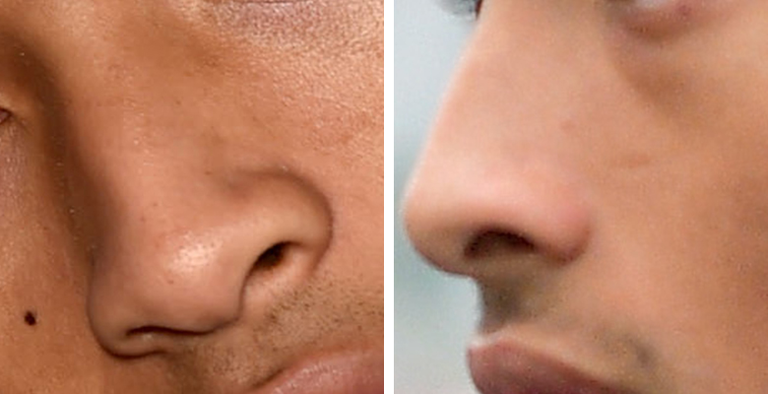 Guess The Celeb Nose!