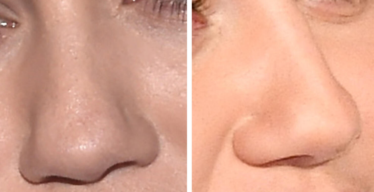 Guess The Celeb Nose!