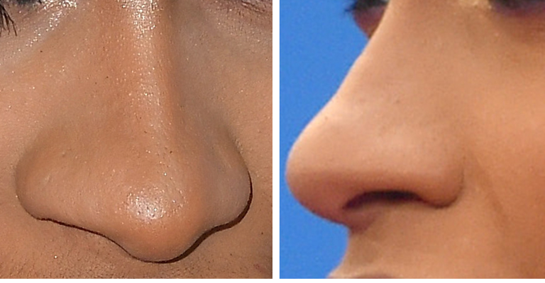 Guess The Celeb Nose!