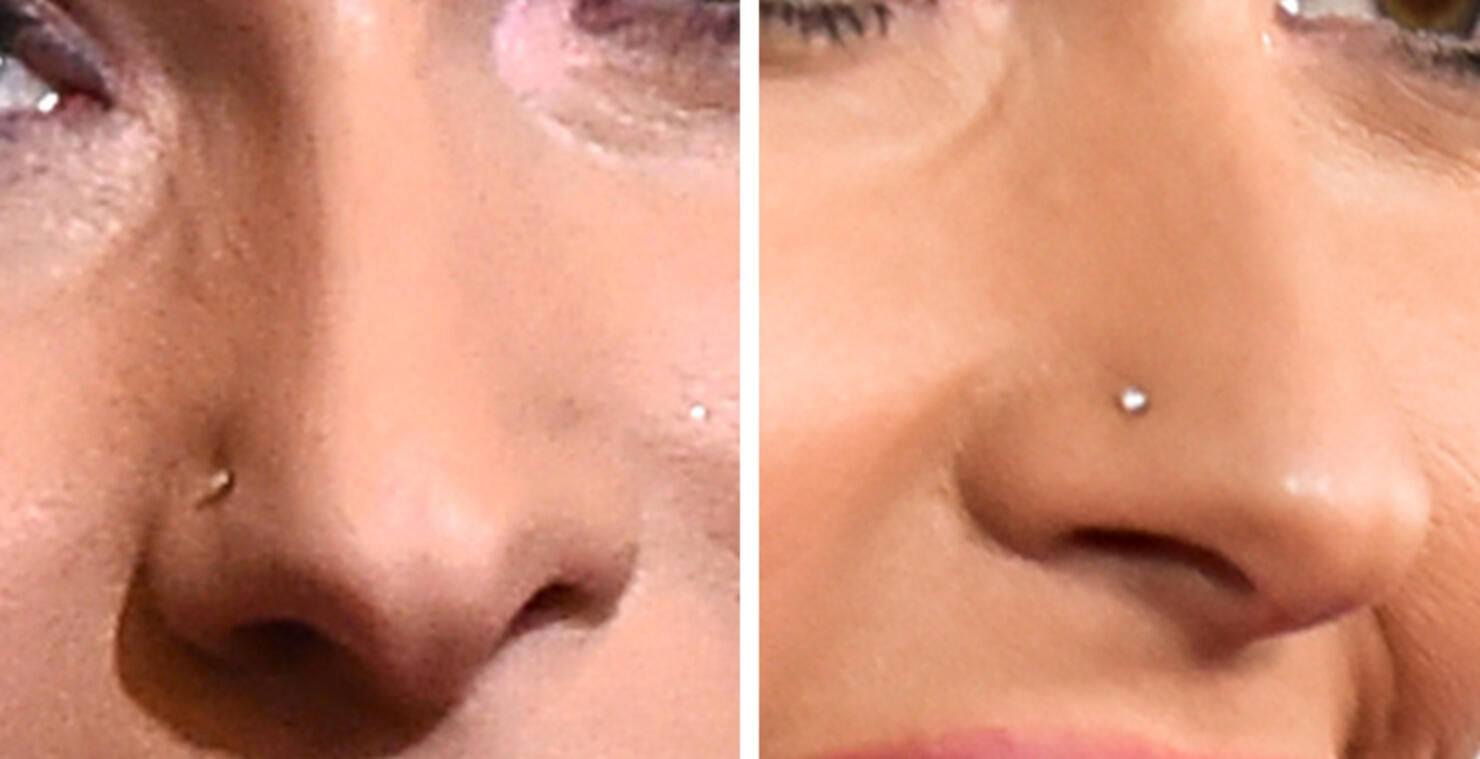 Guess The Celeb Nose!