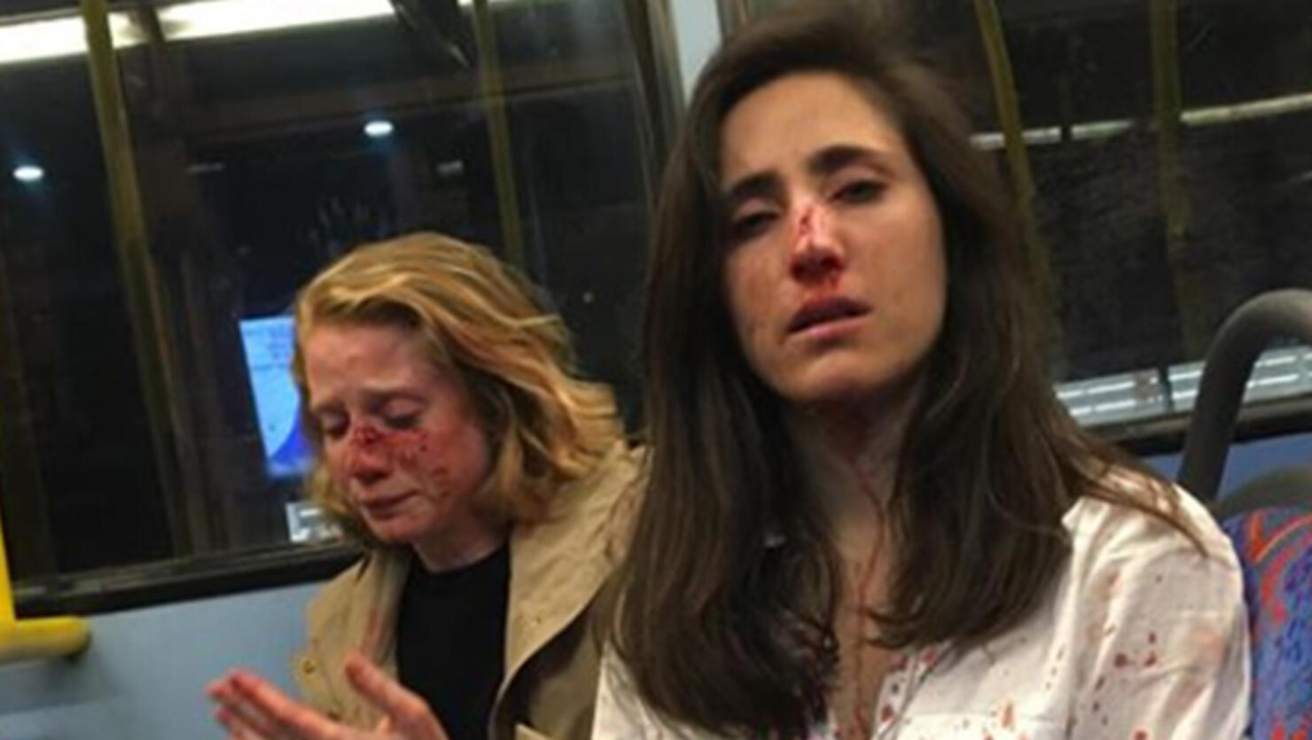 Melania Geymonat and her girlfriend Chris after being assaulted on a bus in London