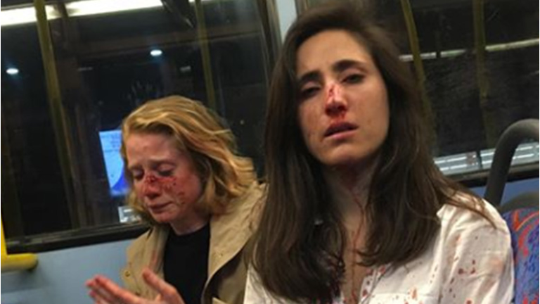 Melania Geymonat and her girlfriend Chris after being assaulted on a bus in London