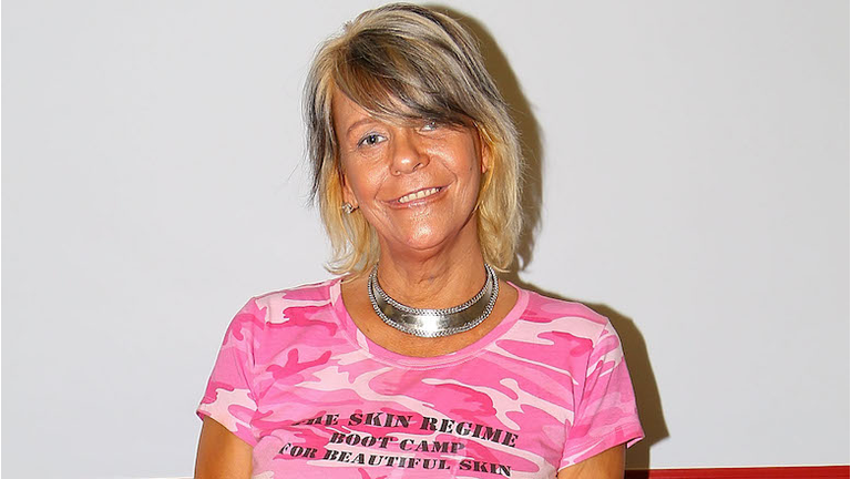 "Tan Mom" Patricia Krentcil Skin Cancer Foundation Event