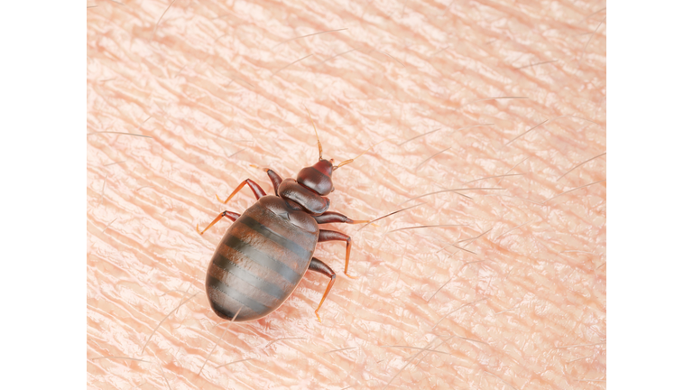 Illustration of a bedbug on human skin