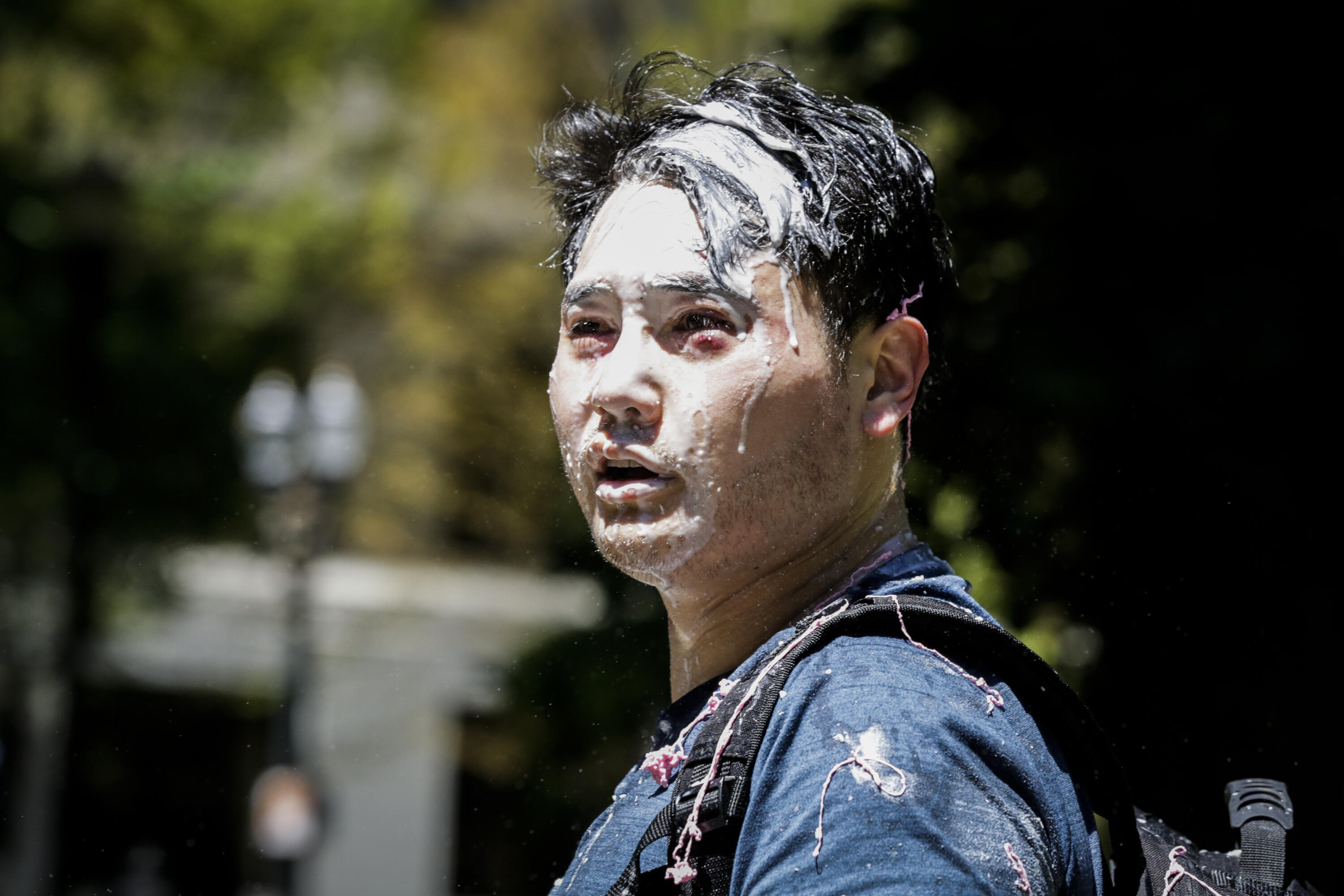 A Brazen, Unprovoked Attack.  Andy Ngo Talks to Armstrong & Getty - Thumbnail Image