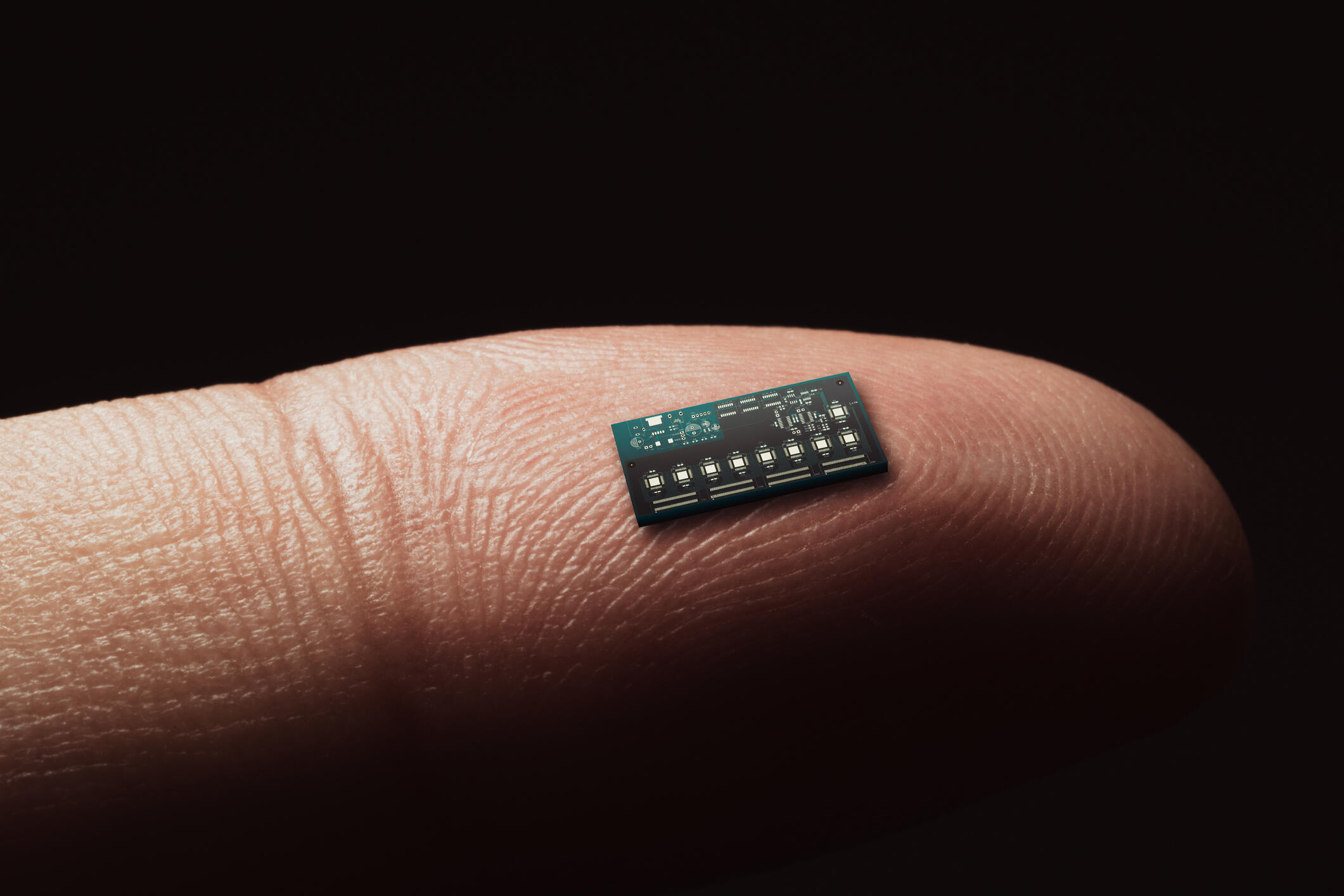 Would You Get A Chip Implanted If It Made Your Life Easier? 1040 WHO