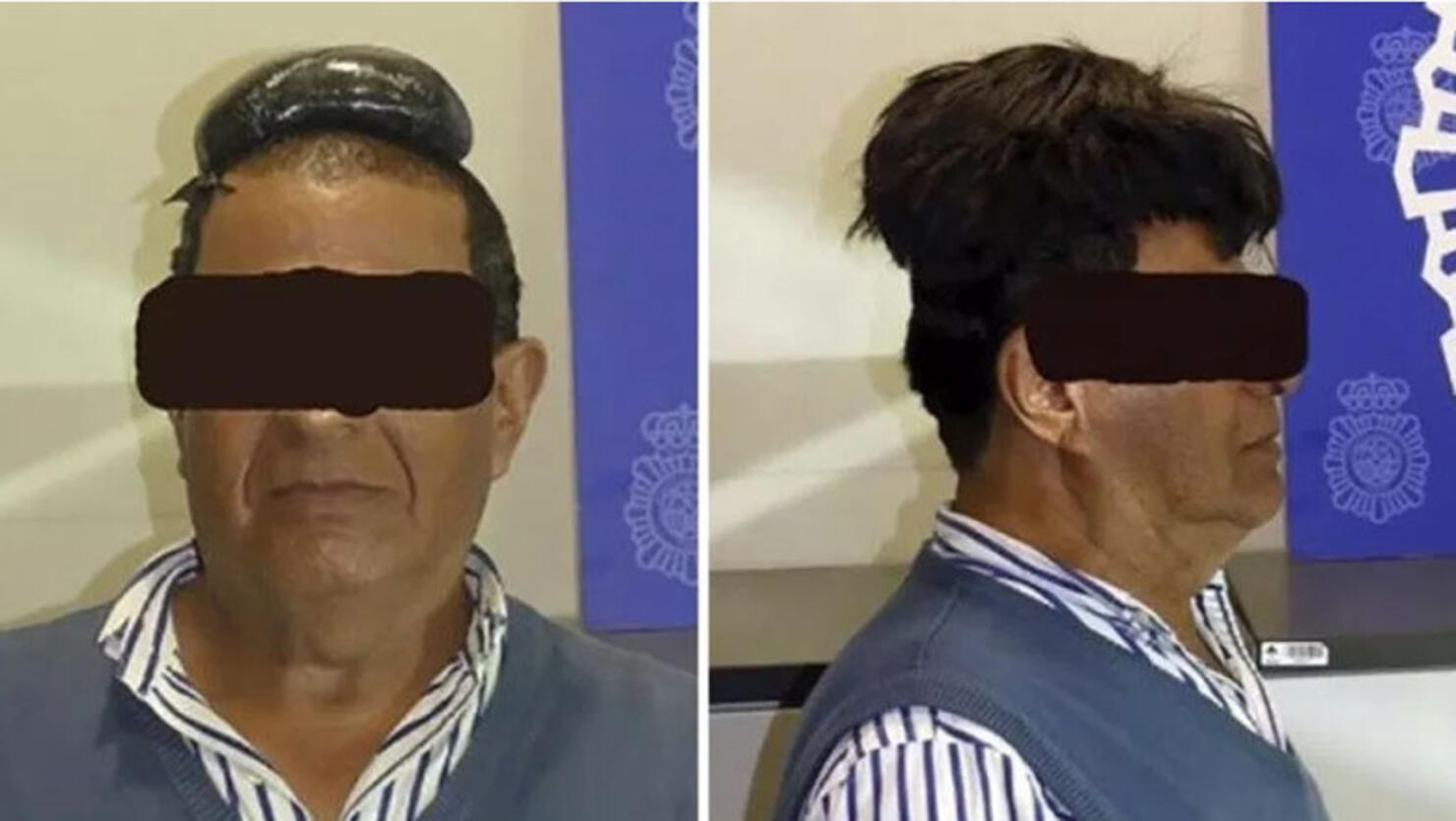 Man accused of smuggling cocaine under his toupee
