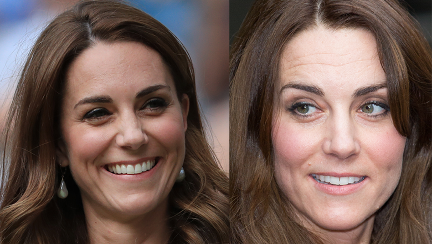 Palace Denies Kate Middleton Got 'Baby Botox' | iHeart