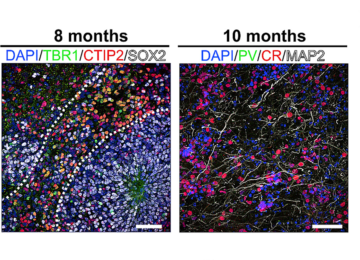 Brain waves detected in mini-brains grown in a dish