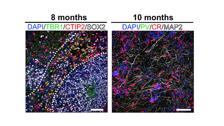 Brain waves detected in mini-brains grown in a dish