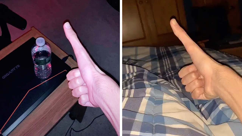 Student with 5-inch-long thumb goes viral. Seen his TikTok videos yet?