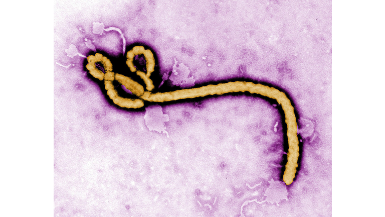 Ebola Virus