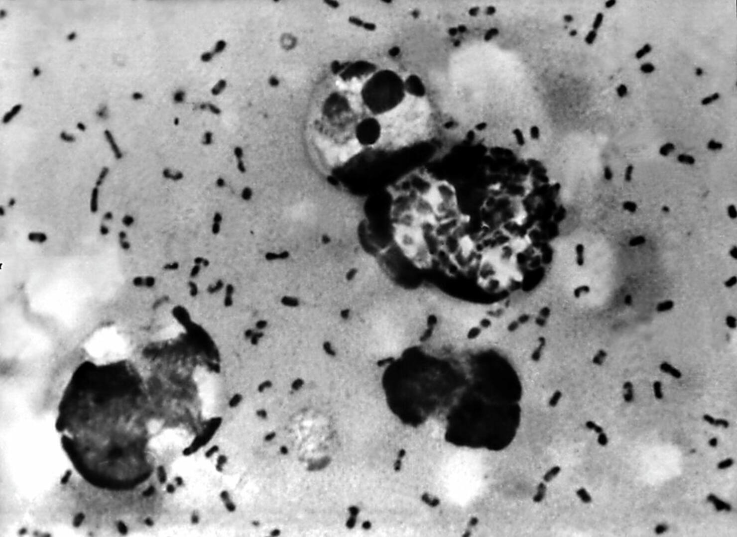 Vials Of Bacteria That May Cause Plague Missing From TX University
