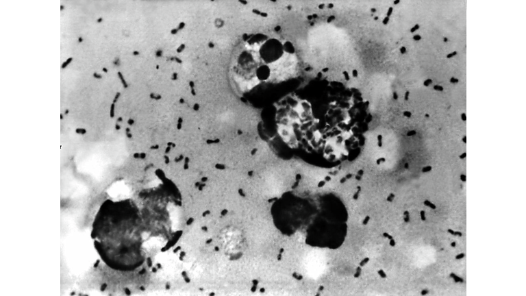 Vials Of Bacteria That May Cause Plague Missing From TX University