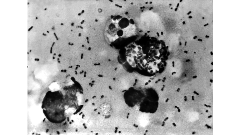 Vials Of Bacteria That May Cause Plague Missing From TX University