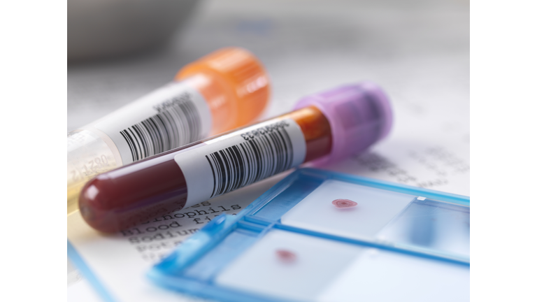 Blood and urine samples with medical results