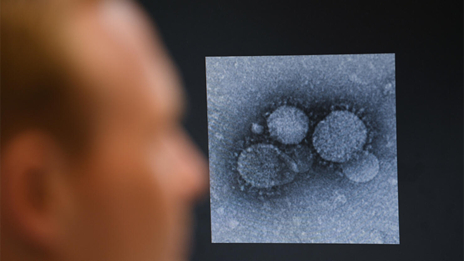 Marburg researchers are looking for a vaccine against coronavirus