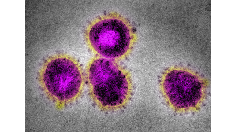 EM Coronavirus, causing SARS