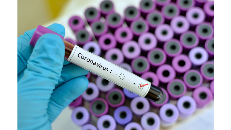 Coronavirus positive