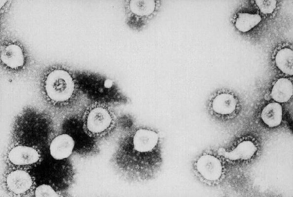 CDC Says SARS Might Be A Form Of The Coronavirus