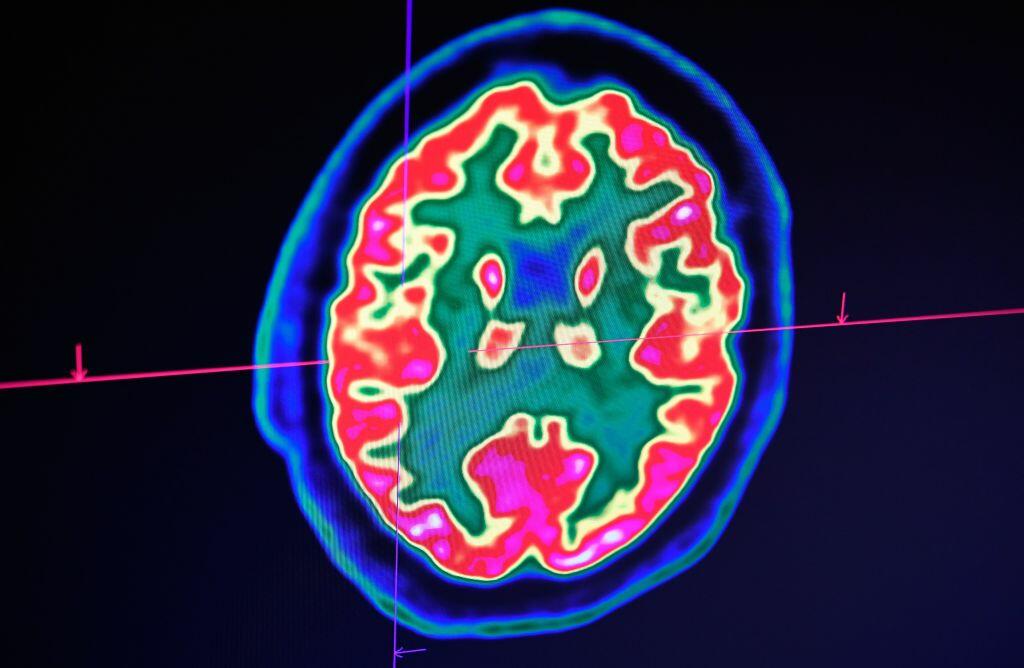 Are you Left-Brained Or Right-Brained?  - Thumbnail Image