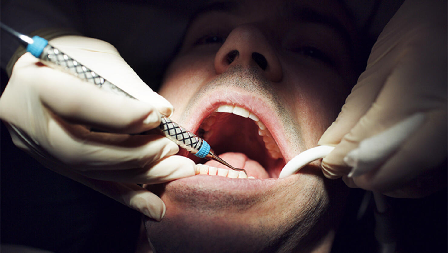 dentist visit