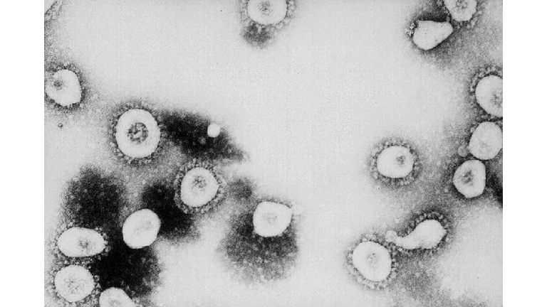 CDC Says SARS Might Be A Form Of The Coronavirus