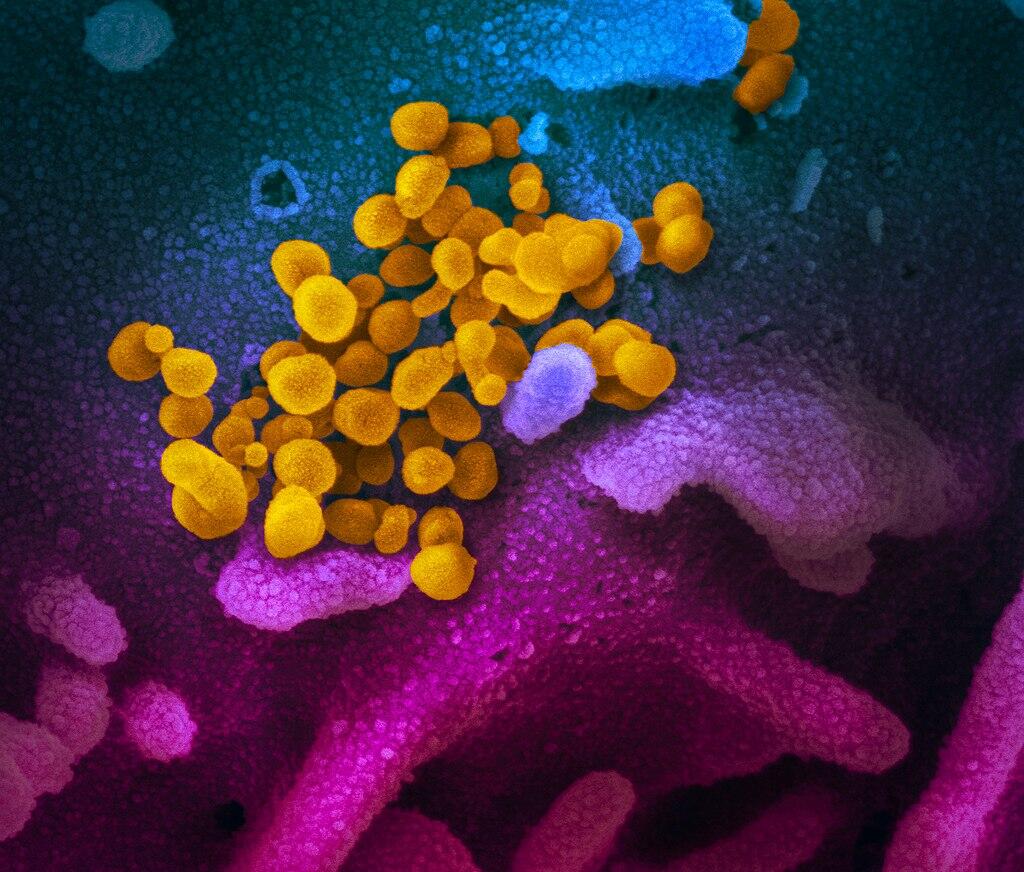 World Health Organization Declares COVID-19 Coronavirus Outbreak a Pandemic - Thumbnail Image