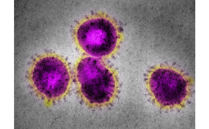 EM Coronavirus, causing SARS