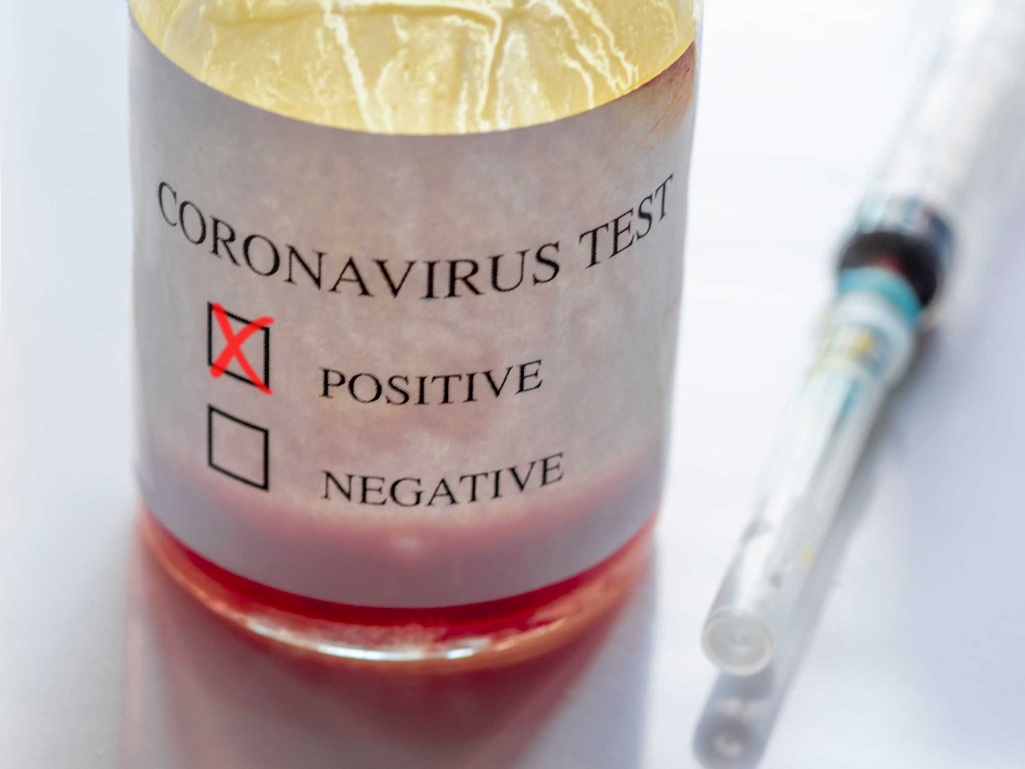 Minnesota now has TWO confirmed cases of Coronavirus - Thumbnail Image