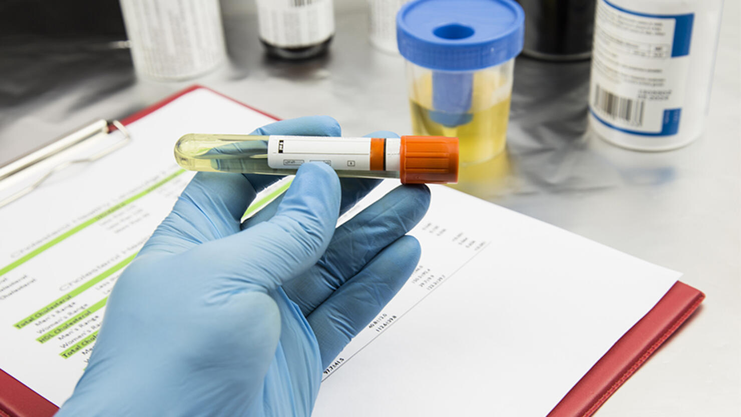 urine test