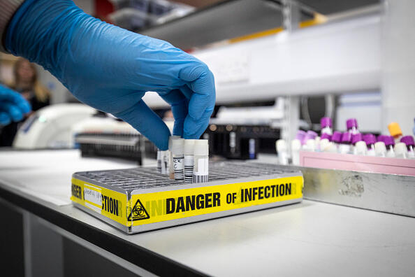 How To Handle Anxiety And Depression During The Coronavirus Outbreak - Thumbnail Image