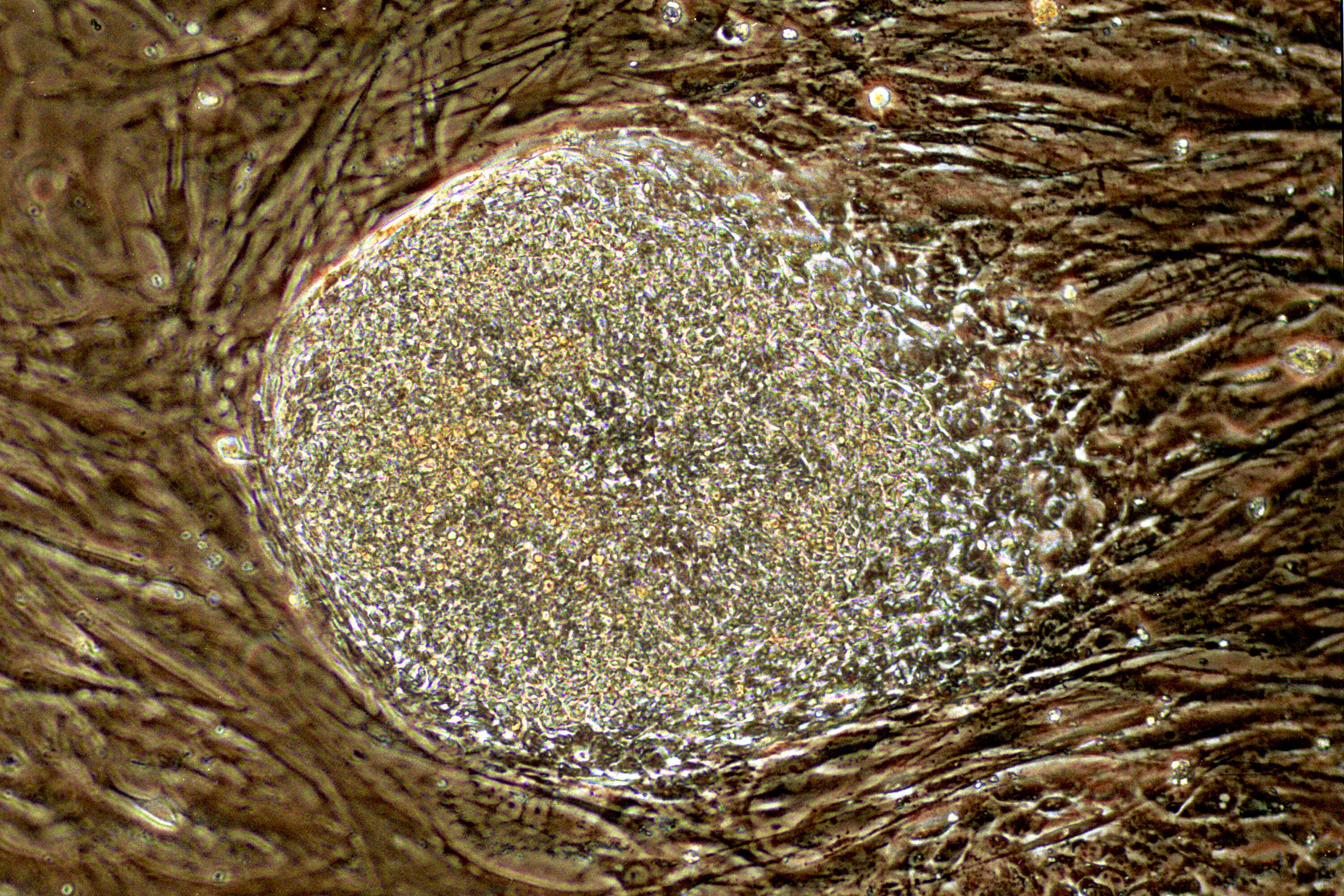 Doctor Cured Elderly Coronavirus Patients Using Stem Cells - Thumbnail Image