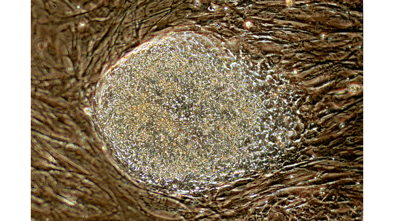 Stem Cells in Israeli Laboratory