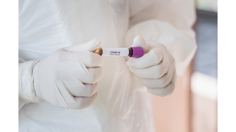 Asian male doctor holding Covid-19 Blood Sample on White Background