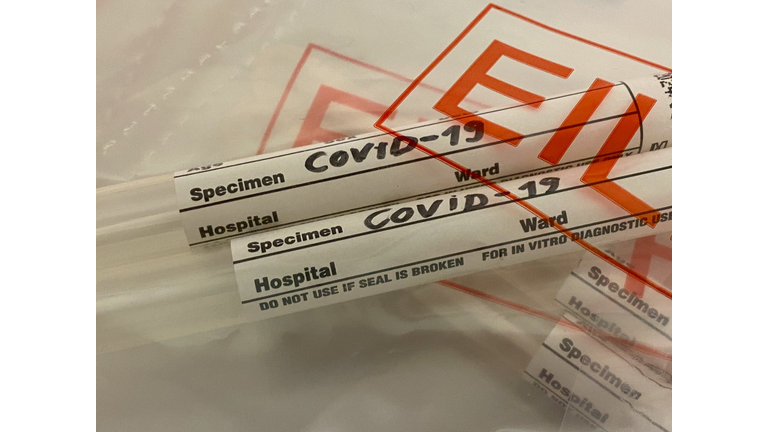 Coronavirus COVID-19 medical swab. (Getty Images)