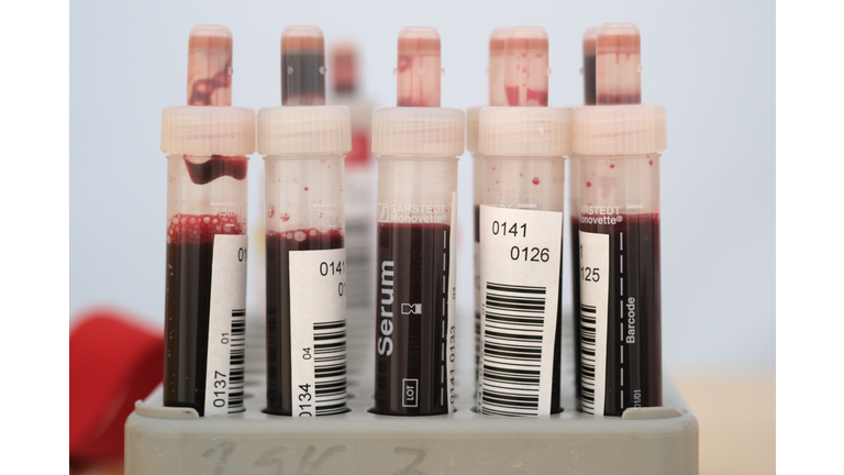 Berlin Doctor Offers Covid-19 Testing