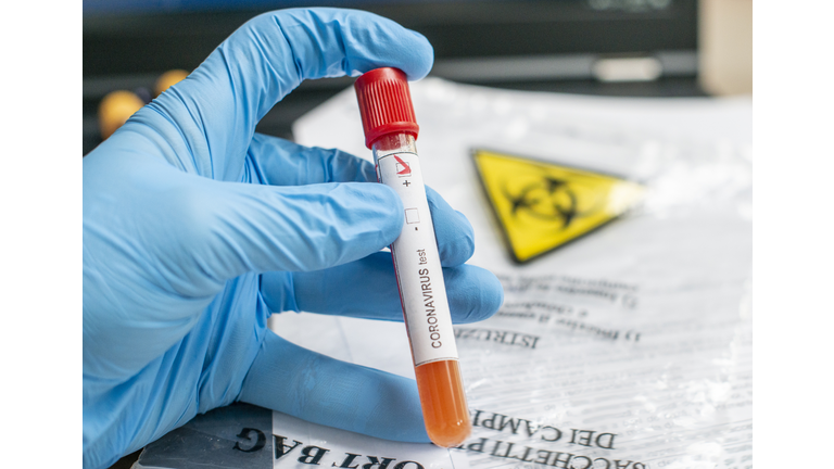Close up of microbiologist hand with surgical gloves holding a blood test tube for coronavirus. Test tubes with blood sample for covid-19 virus, biohazard transportation bag