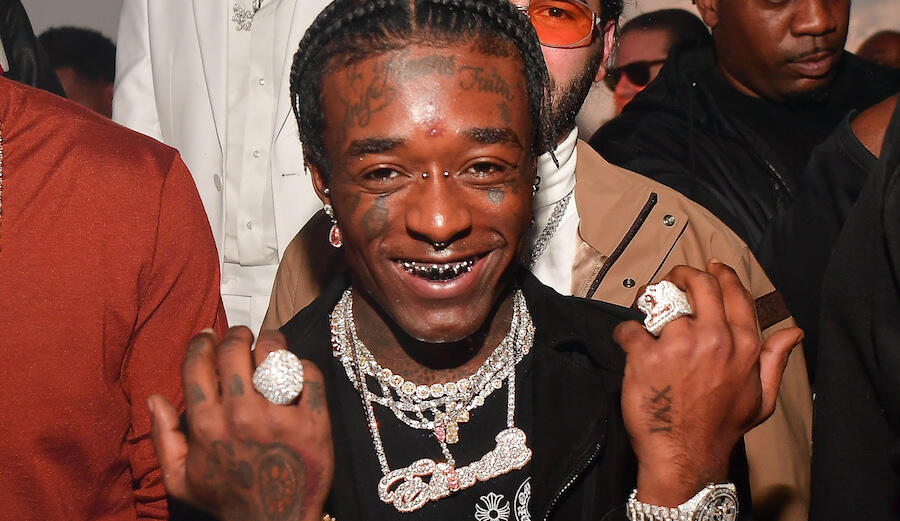 Lil Uzi Vert Had A 24m Pink Diamond Implanted On His Forehead Iheart