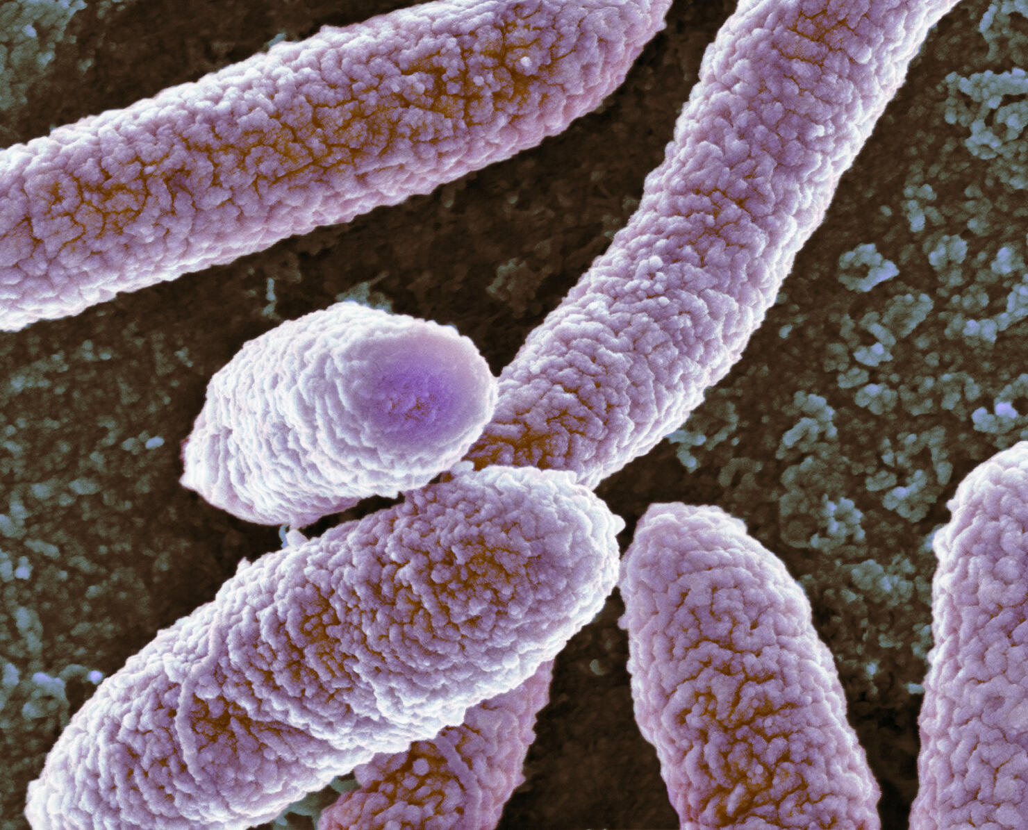 Yogurt Brand May Be Linked To Toxic E. Coli Outbreak In Washington | iHeart 