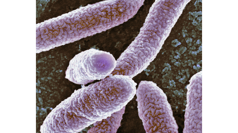 E coli bacteria, SEM