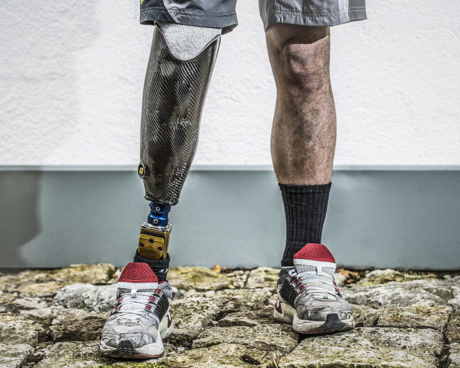 Man with prosthetic leg