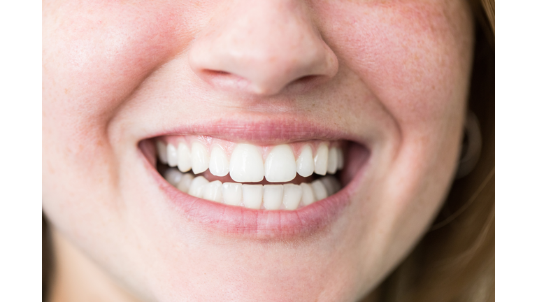 Woman with beautiful toothy smile