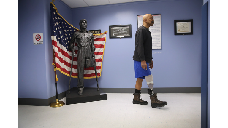 VA Hospital Provides Amputees With Prosthetics And Adaptive Sports