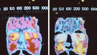 Thermography & Sound