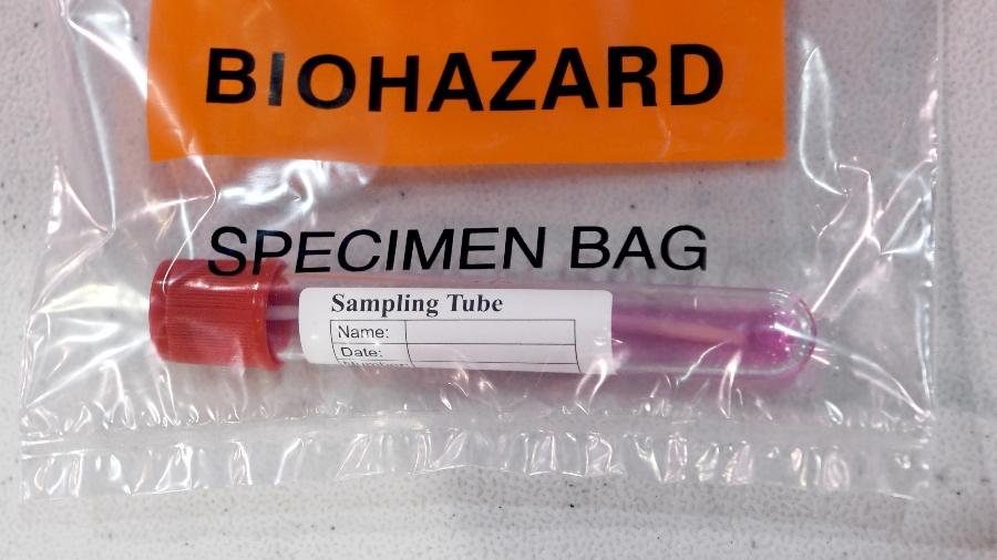 US Confirms First Case Of Omicron Variant In California | iHeart
