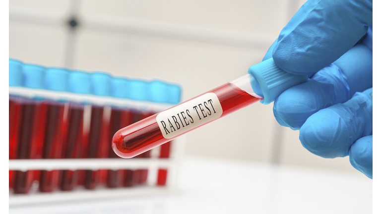 Rabies blood test, conceptual image